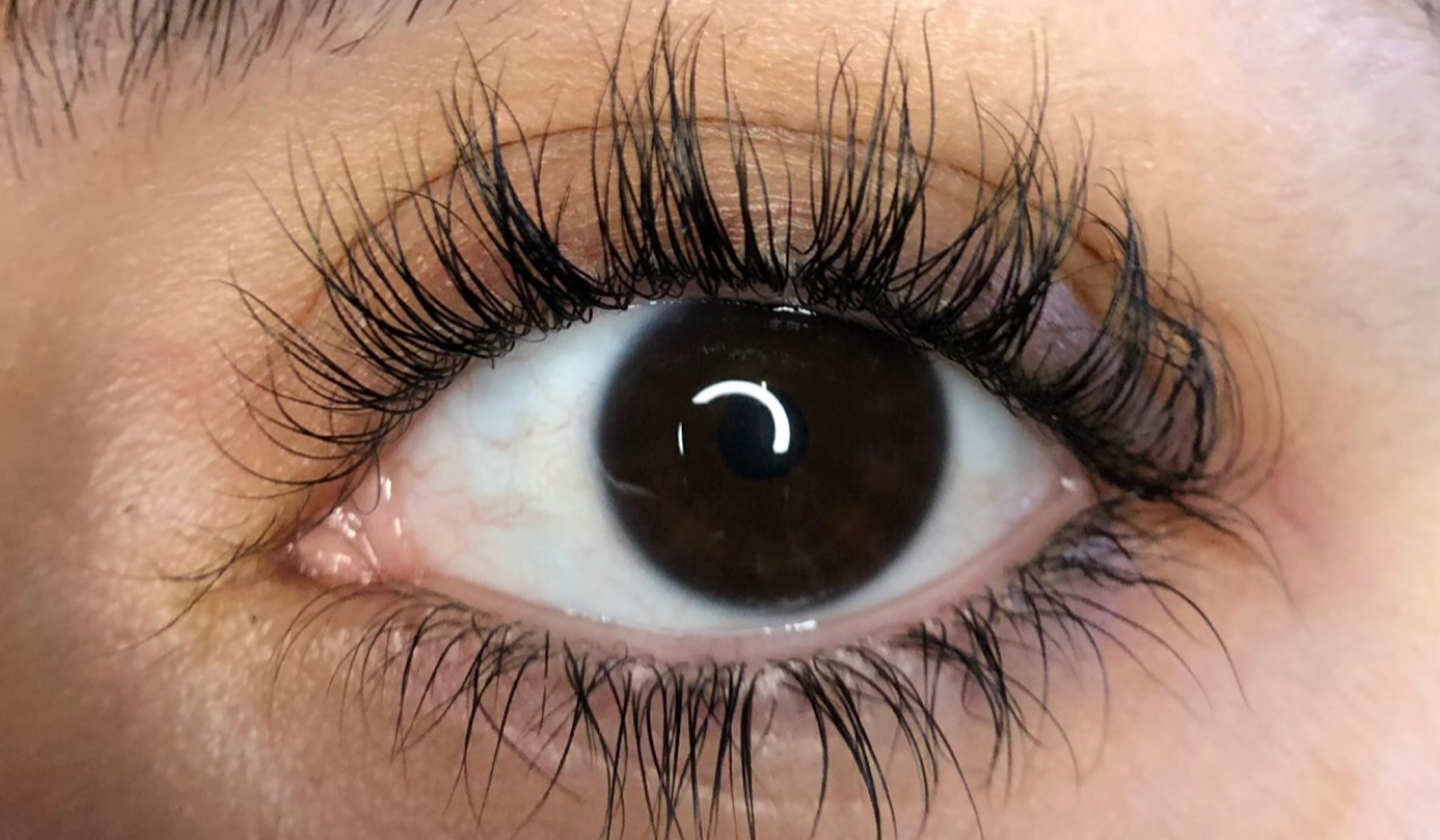 Eyelash Loss? It Could Be Blepharitis – Here's How to Support Lash Appearance After With Nuur Lash