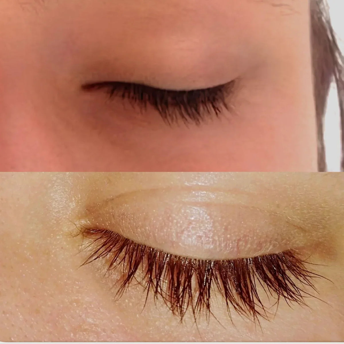 How Long Does Lash Serum Take to Work? A Clinically Informed Guide